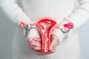 Frau hält Modell von Gebärmutter in den Händen, auf dem man Endometrioseherde erkennen kann