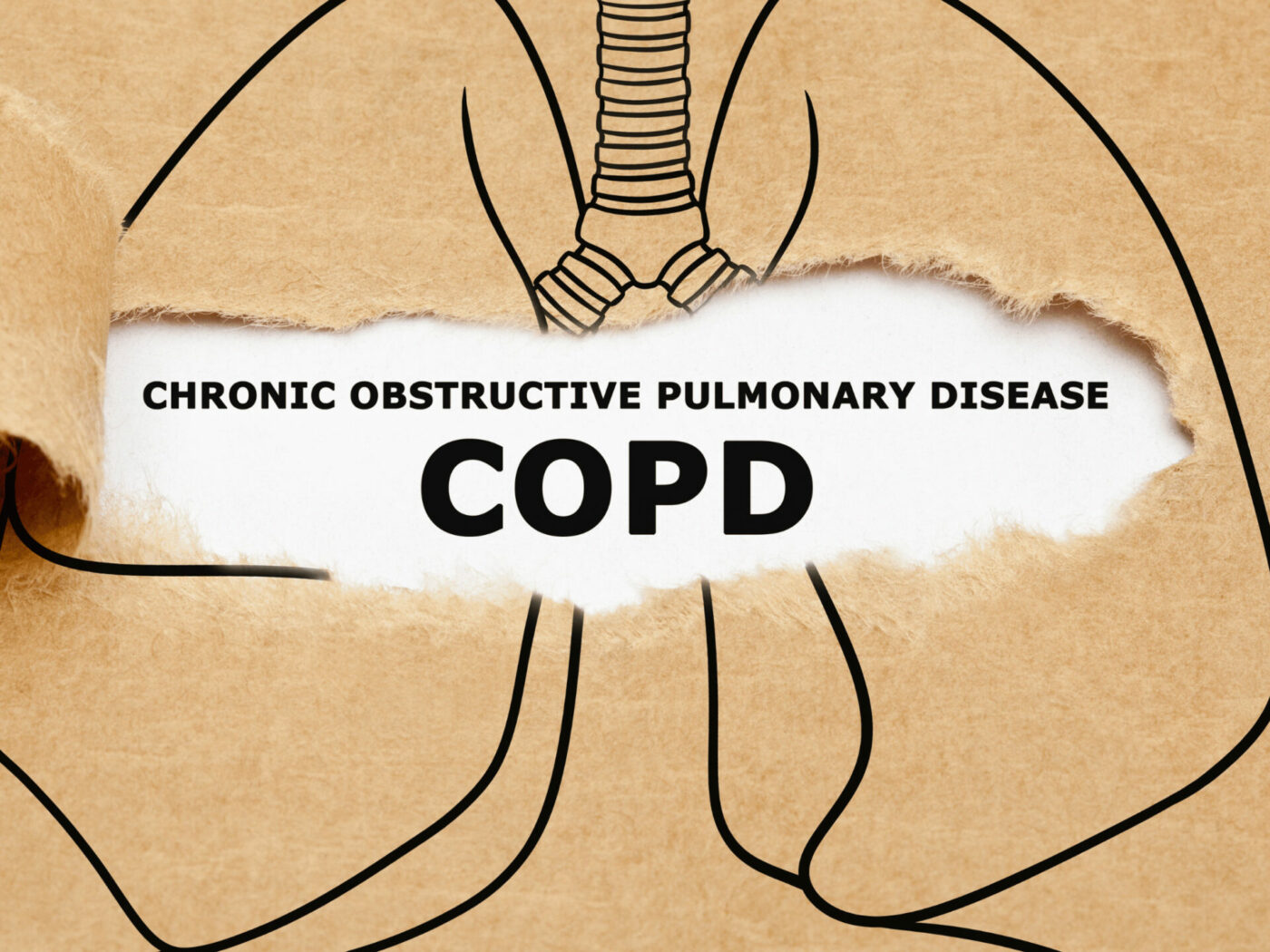 Aufgerissene Zeichnung auf Pappe von einer Lunge mit der Aufschrift Chronic obstructive pulmonary disease COPD